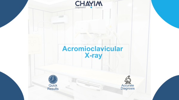 Acromioclavicular X-ray