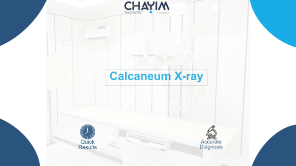 Calcaneum X-ray