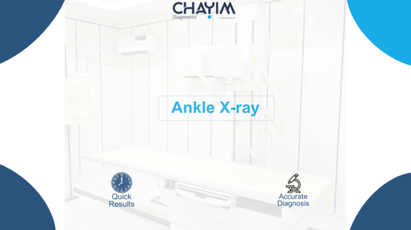 Ankle X-ray