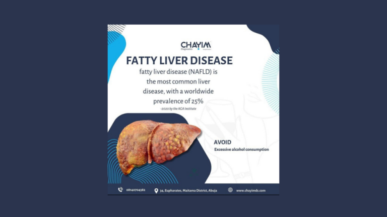 Understanding Fatty Liver and the Detriment of Alcohol Intake