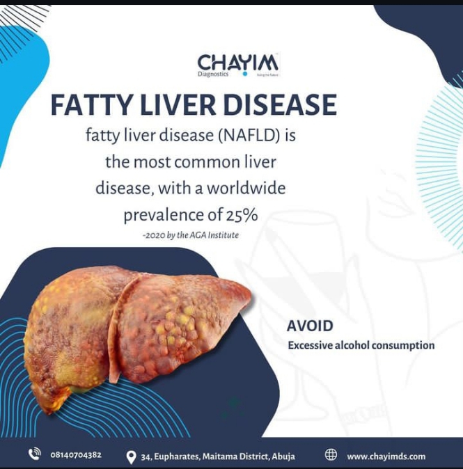 Fatty Liver Disease