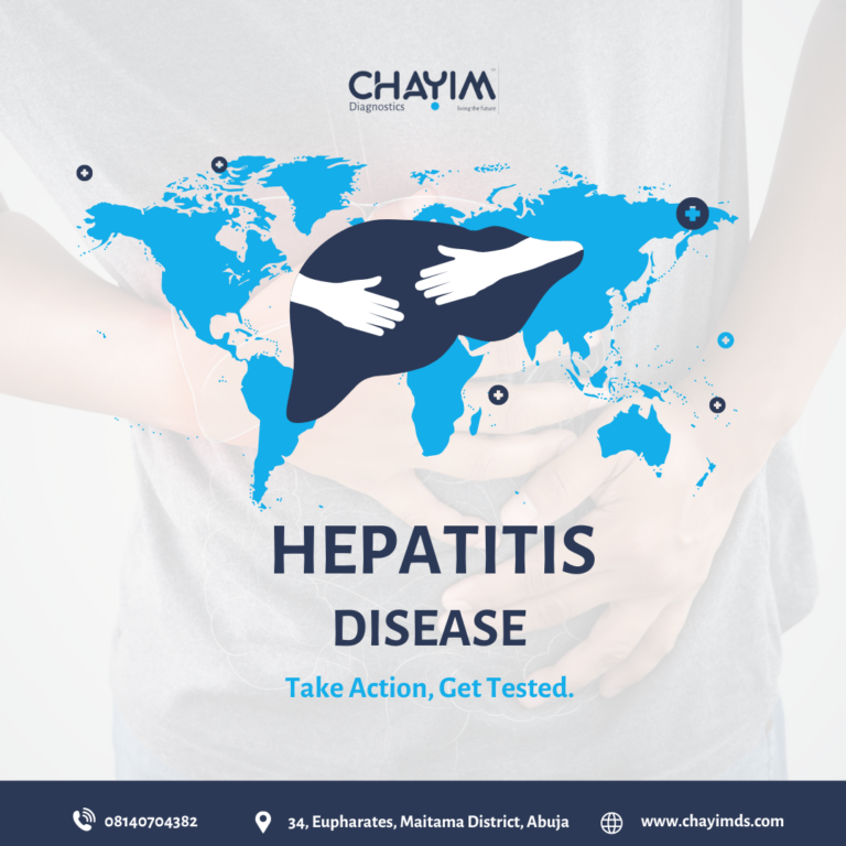 Hepatitis Disease